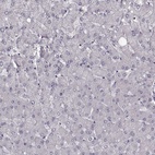 Immunohistochemical staining of human liver shows low expression as expected.