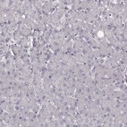 Immunohistochemical staining of human liver shows low expression as expected.