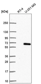 Western blot analysis in human cell line RT-4 and human cell line U-251 MG.