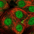 Immunofluorescent staining of human cell line MCF7 shows localization to nucleoplasm & cytosol.