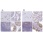 Immunohistochemical staining of human cerebral cortex, kidney, lymph node and testis using Anti-SUGP2 antibody HPA061111 (A) shows similar protein distribution across tissues to independent antibody HPA041557 (B).