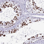 Immunohistochemical staining of human testis shows high expression.