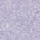 Immunohistochemical staining of human pancreas shows low expression as expected.
