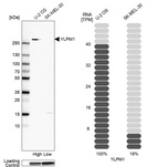 Anti-YLPM1 Antibody