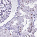 Immunohistochemical staining of human kidney using Anti-SUGP2 antibody HPA061111.