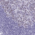 Immunohistochemical staining of human lymph node using Anti-SUGP2 antibody HPA061111.