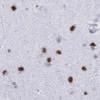 Immunohistochemical staining of human cerebral cortex using Anti-SUGP2 antibody HPA061111.