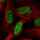 Immunofluorescent staining of human cell line U-2 OS shows localization to nucleoplasm.