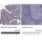 Anti-ANKS4B Antibody