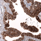 Immunohistochemical staining of human fallopian tube shows strong membranous positivity in glandular cells.