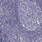 Anti-ANKS4B Antibody