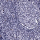 Immunohistochemical staining of human tonsil shows low expression as expected.