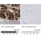 Anti-VAT1L Antibody