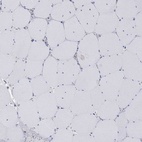 Immunohistochemical staining of human skeletal muscle shows low expression as expected.