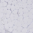 Immunohistochemical staining of human skeletal muscle shows low expression as expected.