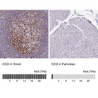 Anti-EED Antibody