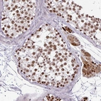Immunohistochemical staining of human testis shows moderate to strong nuclear positivity in cells in seminiferous ducts.