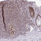 Immunohistochemical staining of human rectum shows moderate nuclear positivity in glandular cells.