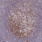 Immunohistochemical staining of human tonsil shows strong nuclear positivity in germinal center cells.