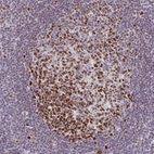 Immunohistochemical staining of human tonsil shows strong nuclear positivity in germinal center cells.