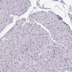 Anti-EED Antibody