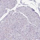 Immunohistochemical staining of human pancreas shows no positivity in exocrine glandular cells.