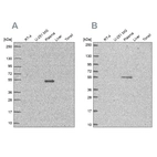 Western blot analysis using Anti-EED antibody HPA061140 (A) shows similar pattern to independent antibody HPA060089 (B).
