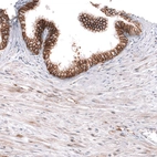 Immunohistochemical staining of human prostate shows strong membranous positivity in glandular cells.