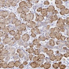 Anti-PPP1R1B Antibody