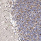 Anti-LONRF3 Antibody