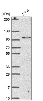 Western blot analysis in human cell line RT-4.