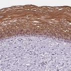 Immunohistochemical staining of human cervix shows strong cytoplasmic positivity in squamous epithelial cells.