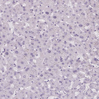 Anti-KRT6A Antibody