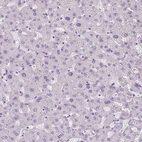 Immunohistochemical staining of human liver shows no positivity in hepatocytes as expected.