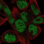 Anti-EBF1 Antibody