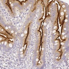 Anti-ASAH2 Antibody
