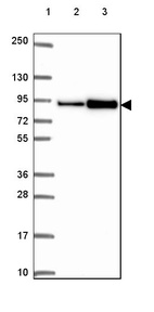 Lane 1: Marker [kDa] 250, 130, 95, 72, 55, 36, 28, 17, 10_br/_Lane 2: Human cell line RT-4_br/_Lane 3: Human cell line U-251 MG