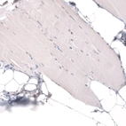 Immunohistochemical staining of human skeletal muscle shows no positivity in myocytes as expected.