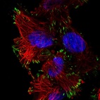 Immunofluorescent staining of human cell line U-251 MG shows localization to focal adhesion sites.