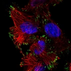 Immunofluorescent staining of human cell line U-251 MG shows localization to focal adhesion sites.