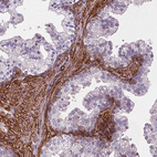 Immunohistochemical staining of human prostate shows strong membranous positivity in smooth muscle cells.