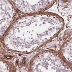 Immunohistochemical staining of human testis shows strong membranous positivity in peritubular myoid cells.