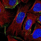 Immunofluorescent staining of human cell line U-2 OS shows localization to vesicles.