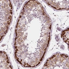 Anti-LSM14B Antibody