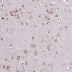 Immunohistochemical staining of human cerebral cortex shows moderate cytoplasmic positivity in neurons.