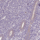 Anti-LSM14B Antibody