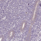 Immunohistochemical staining of human endometrium shows weak cytoplasmic positivity in glandular cells.