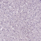 Immunohistochemical staining of human liver shows no positivity in hepatocytes as expected.