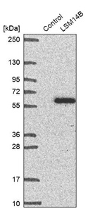 Anti-LSM14B Antibody