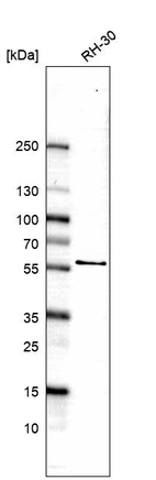 Western blot analysis in human cell line RH-30.